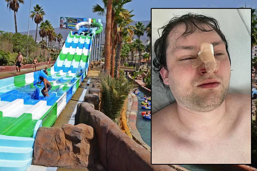 British tourist wants €1,500 compensation after breaking his nose at water park in Tenerife